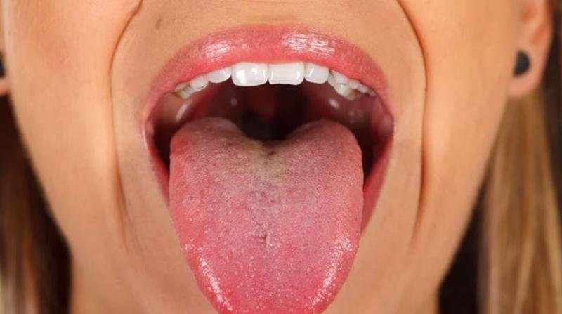 बी12 की कमी से कमजोर होती नर्व्स और ब्रेन हेल्थ— अनदेखा करना पड़ सकता है भारी बी12 की कमी से कमजोर होती नर्व्स और ब्रेन हेल्थ— अनदेखा करना पड़ सकता है भारी